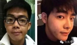 男网红整容脸吃瓜图片,吃瓜群众热议男网红变脸之谜