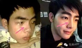 男网红整容脸吃瓜图片,吃瓜群众热议男网红变脸之谜