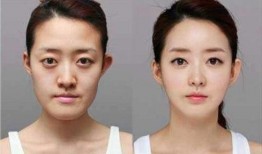 男网红整容脸吃瓜图片,吃瓜群众热议男网红变脸之谜