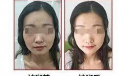 徒手祛斑爆料图片搞笑视频,搞笑视频带你领略祛斑新潮流